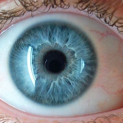 Aklınıza gelir miydi? Bunu yapan sinüzit