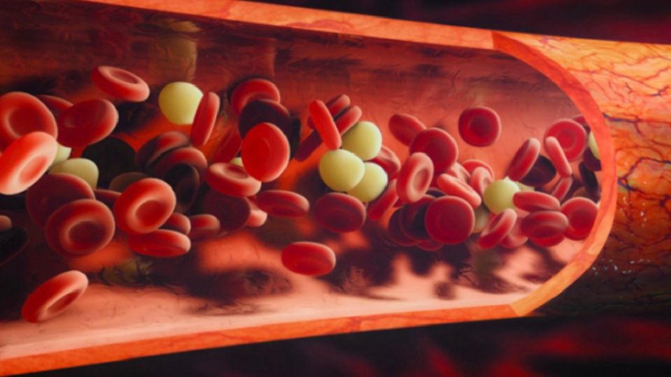 Bu belirtilere dikkat! Bacak damar tıkanıklığınız olabilir