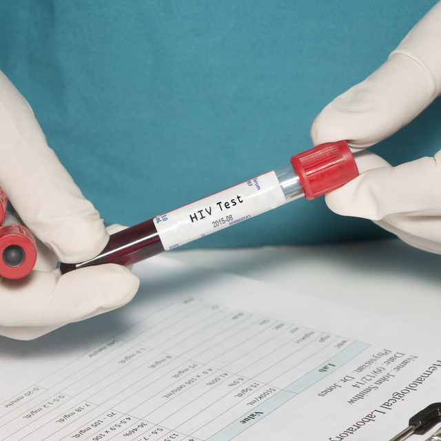Prof. Dr. Şener açıkladı! Sessiz HIV pandemisi