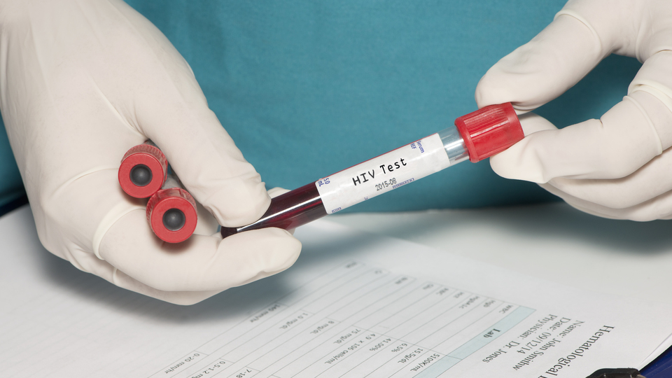 Prof. Dr. Şener açıkladı! Sessiz HIV pandemisi