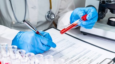 Kanser tanısı olmayan hastalarda kanser belirteçlerinin kanda test edilmesi doğru mu?