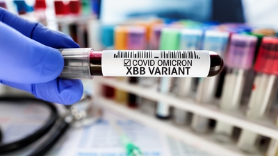 Bilim Kurulu Üyesi Prof. Dr. Şener'den XBB.1.5 varyantı açıklaması