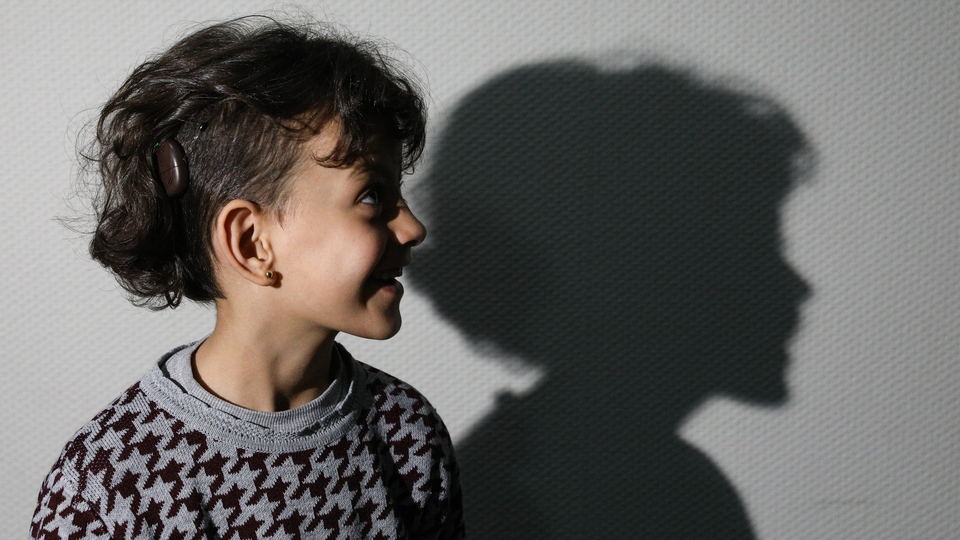 6 yaşındaki Kader, biyonik kulakla duydu