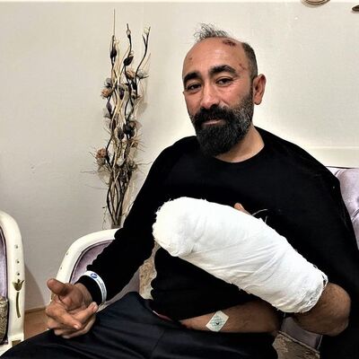 Taksicinin başına taşla vurmuştu! Nedeni ortaya çıktı!