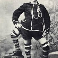 Doğduğunda üç bacağı, üç ayağı ve iki cinsel organı vardı: İlginç bir hayat yaşadı