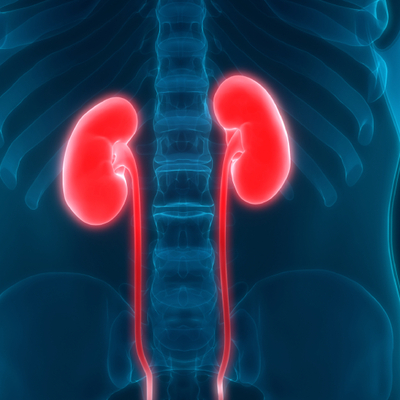 Böbrek kanseri sinsi ilerliyor! İşte en önemli risk faktörleri