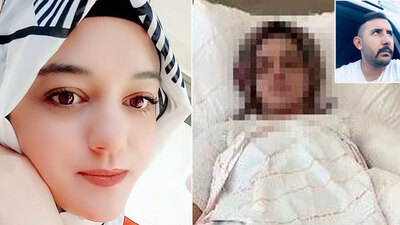 Eski nişanlısının yüzüne kimyasal attı! Pişkin savunma!