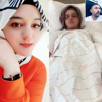 Eski nişanlısının yüzüne kimyasal attı! Pişkin savunma!