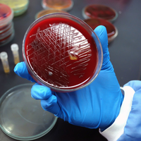 Strep A uyarısı! "Türkiye orta riskli grupta"