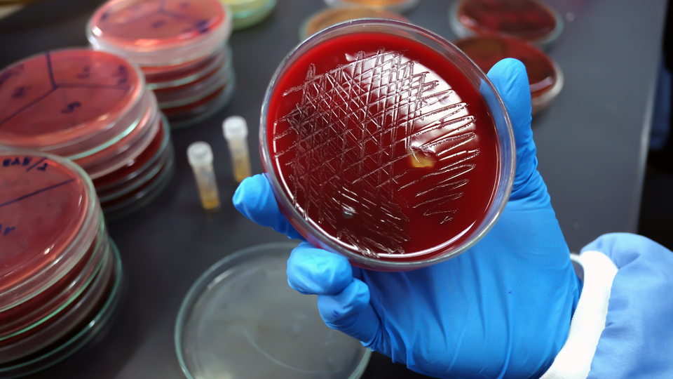 Strep A uyarısı! "Türkiye orta riskli grupta"