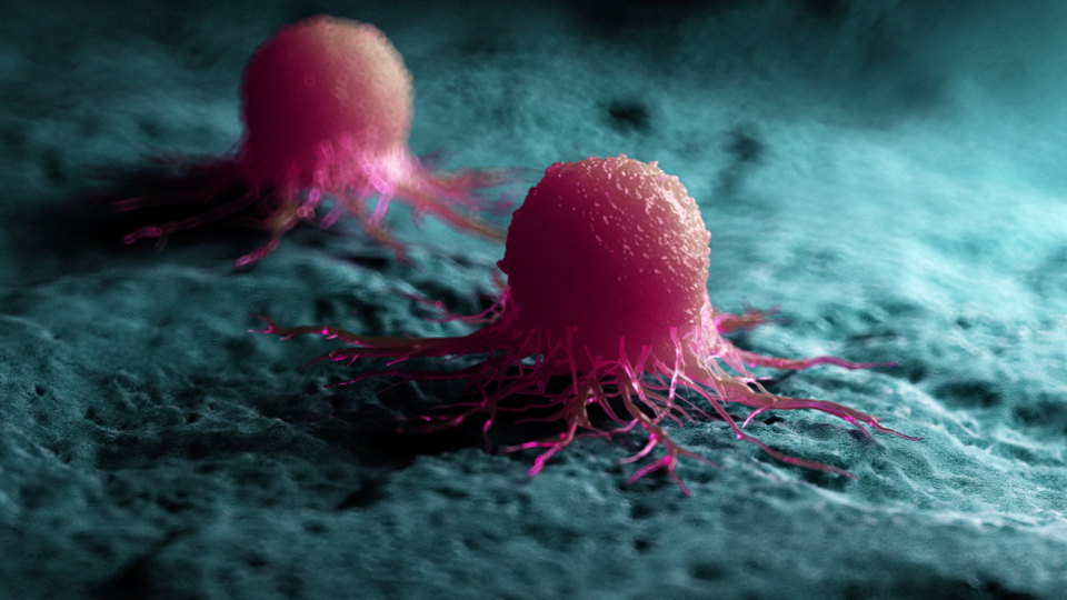 Erkeklerde en sık akciğer, kadınlarda meme kanseri görülüyor