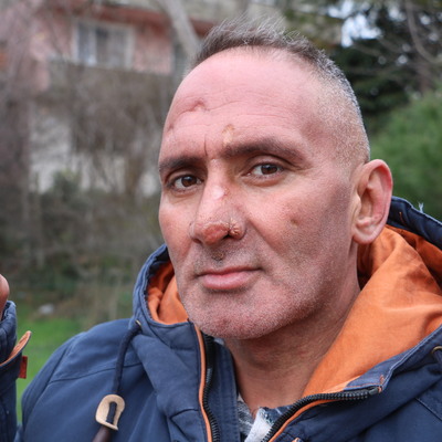 Sinek yüzünü tanınmayacak hale getirdi