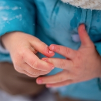 Deprem bölgelerinde hipotermi tehlikesi!