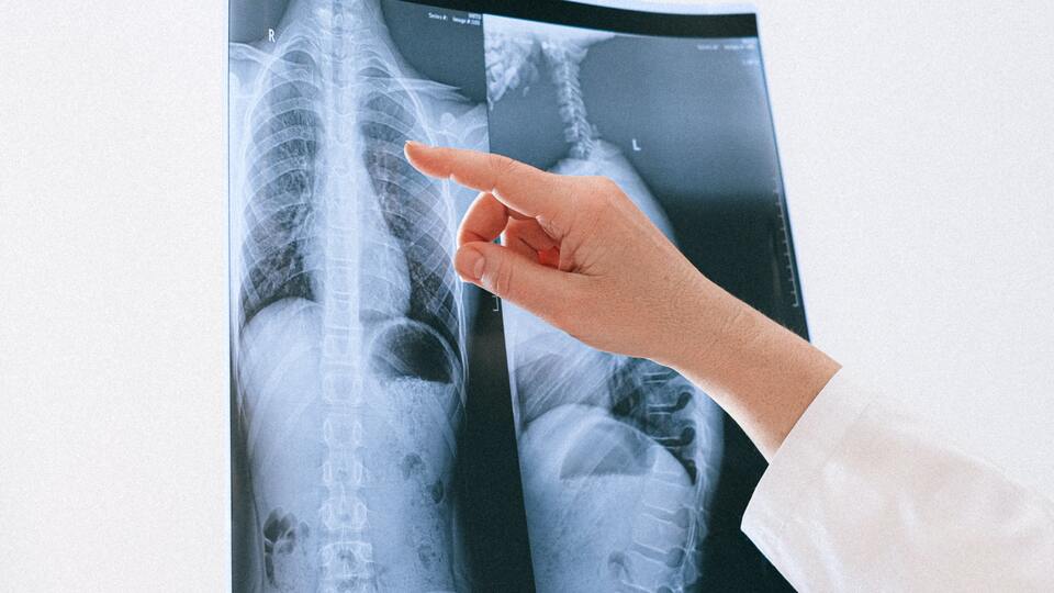 Akciğer nerede, görevi nedir ve ne işe yarar?