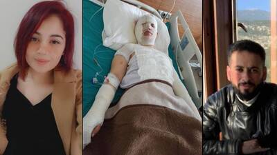 Eski eşin vicdansızlığı "pes" dedirtti! Depremzede kadını kaynar suyla yaktı