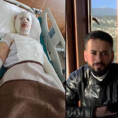 Eski eşin vicdansızlığı "pes" dedirtti! Depremzede kadını kaynar suyla yaktı