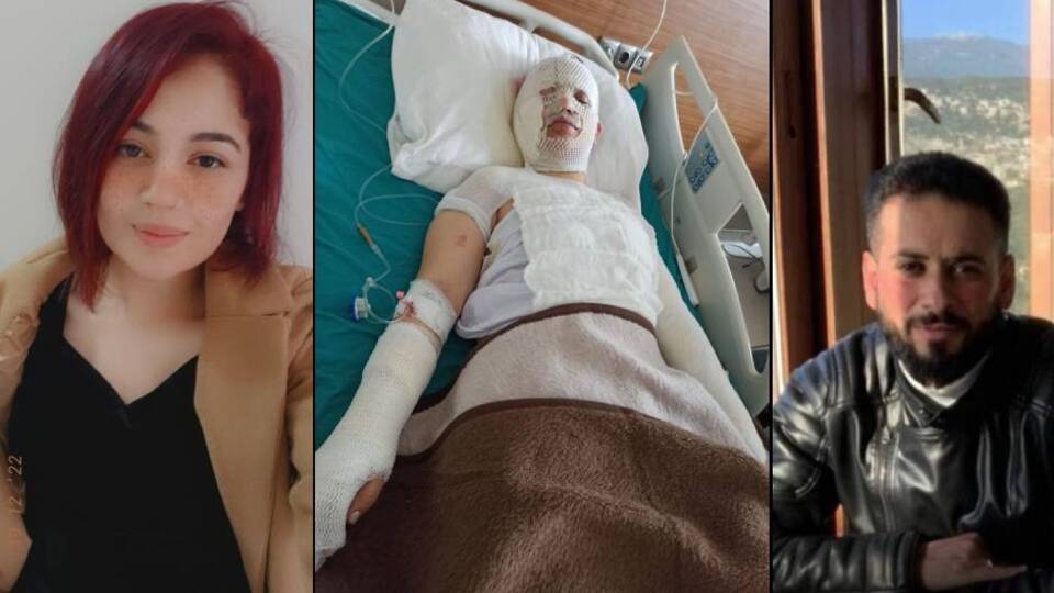 Eski eşin vicdansızlığı "pes" dedirtti! Depremzede kadını kaynar suyla yaktı