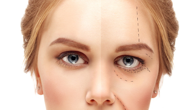 Göz kapağı ameliyatı sonrası dikkat edilmesi gerekenler