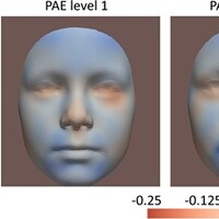 Hamilelikte alkol tüketimine karşı yeni bir araştırma