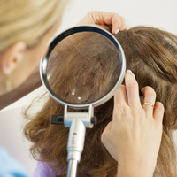 Saç biti nasıl temizlenir?