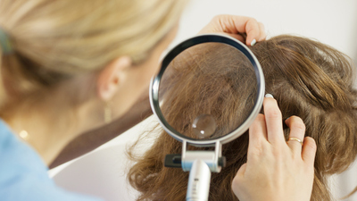 Saç biti nasıl temizlenir?