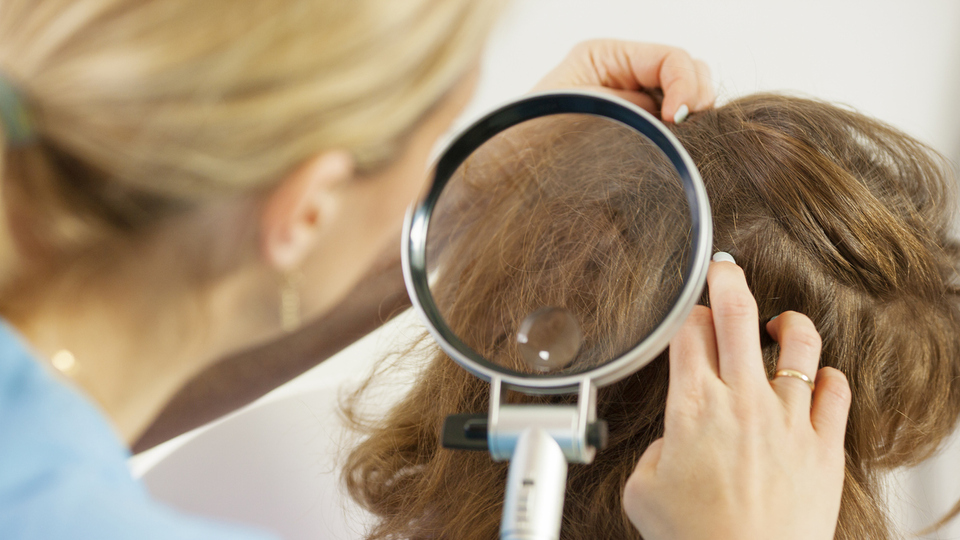 Saç biti nasıl temizlenir?