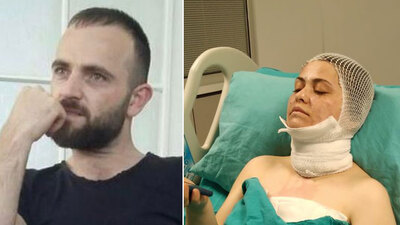 Eski eşinin yüzüne kezzap atmıştı! Ceza mı ödül mü?