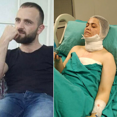 Eski eşinin yüzüne kezzap atmıştı! Ceza mı ödül mü?