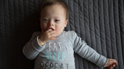 Her 800 bebekten biri Down sendromu ile dünyaya geliyor