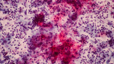 ABD'deki sağlık tesislerinde ölümcül risk