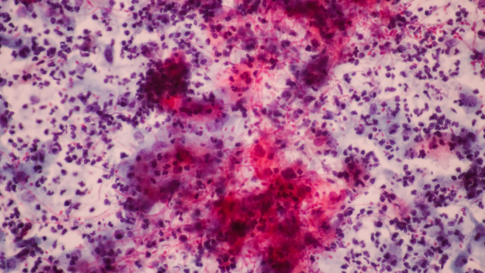 ABD'deki sağlık tesislerinde ölümcül risk