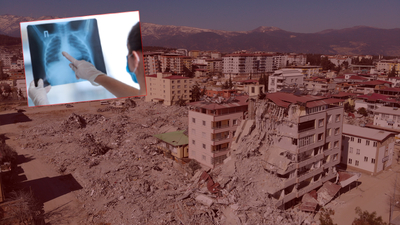 Deprem bölgesinde tüberküloz uyarısı!