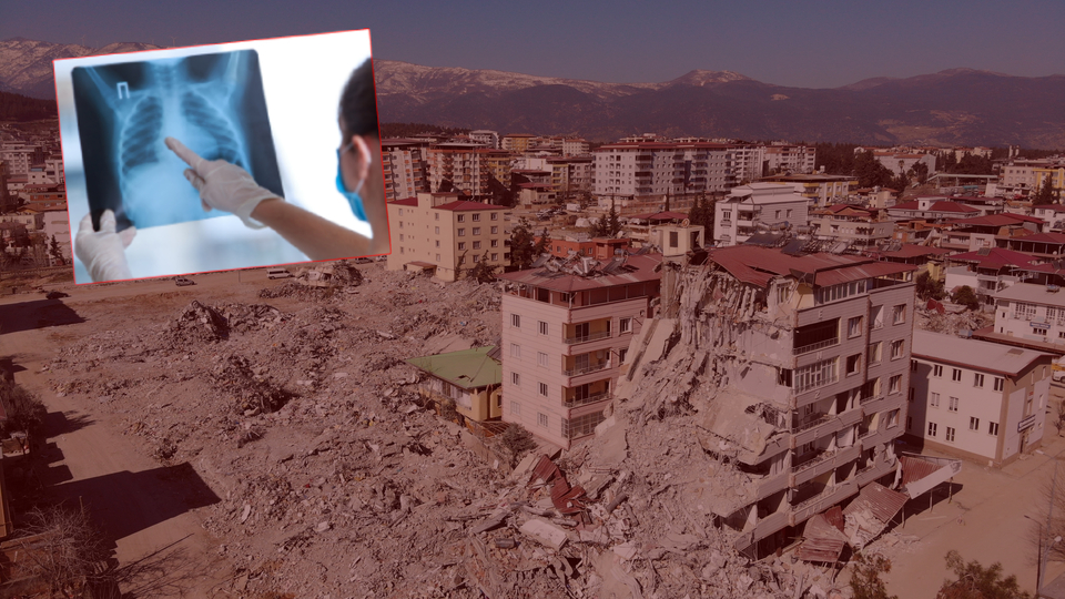 Deprem bölgesinde tüberküloz uyarısı!