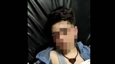 14 yaşındaki çocuğun darp edilmesine ilişkin açıklama