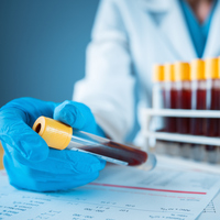 PLT nedir, neden olur ve normal değeri kaç olmalı?