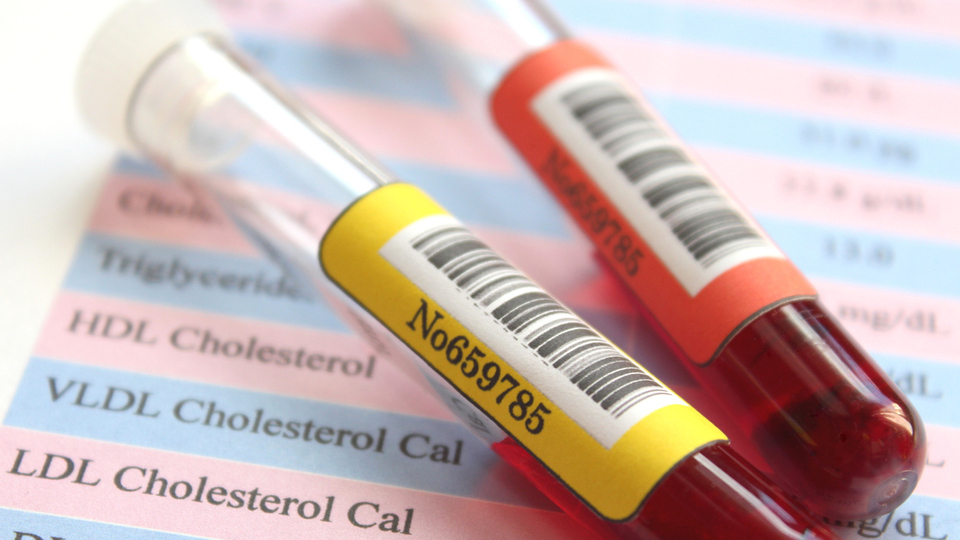 HDL kolesterol nedir, neden olur ve normal değeri kaç olmalı?
