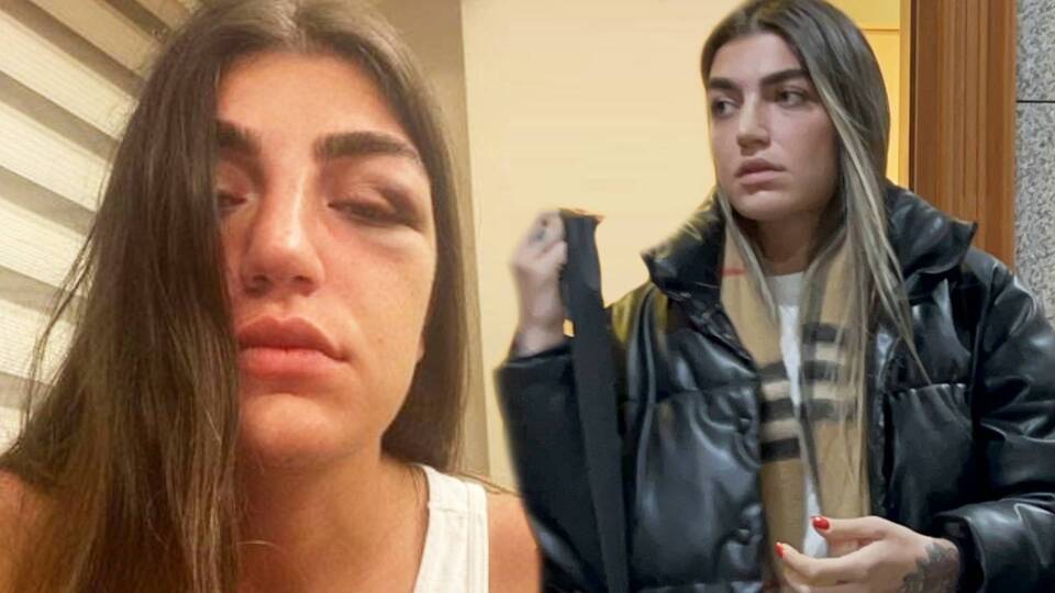 1 yıla kadar hapis cezası istendi