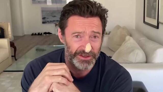 Biyopsi sonucunu açıkladı