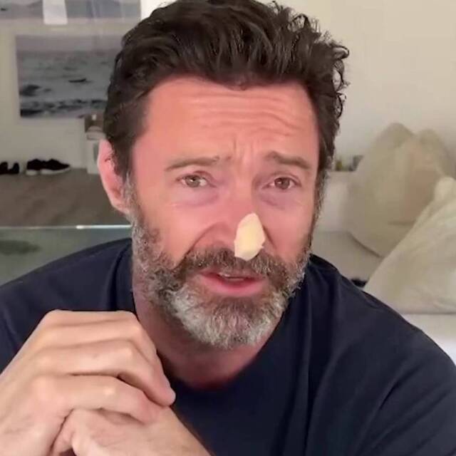 Biyopsi sonucunu açıkladı