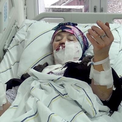 Kurt dehşetini anlattı! "Kâbus gibiydi!"