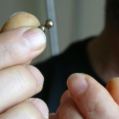 Anne babalar dikkat! Mıknatıslı topu yuttu bağırsağı delindi!