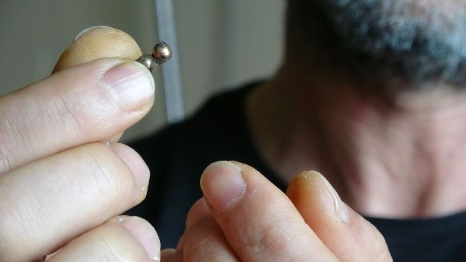 Anne babalar dikkat! Mıknatıslı topu yuttu bağırsağı delindi!