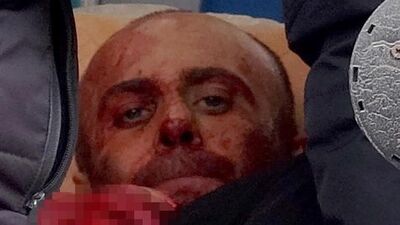 Babasını yaralamış annesini öldürmüştü! İşte caninin ifadesi!