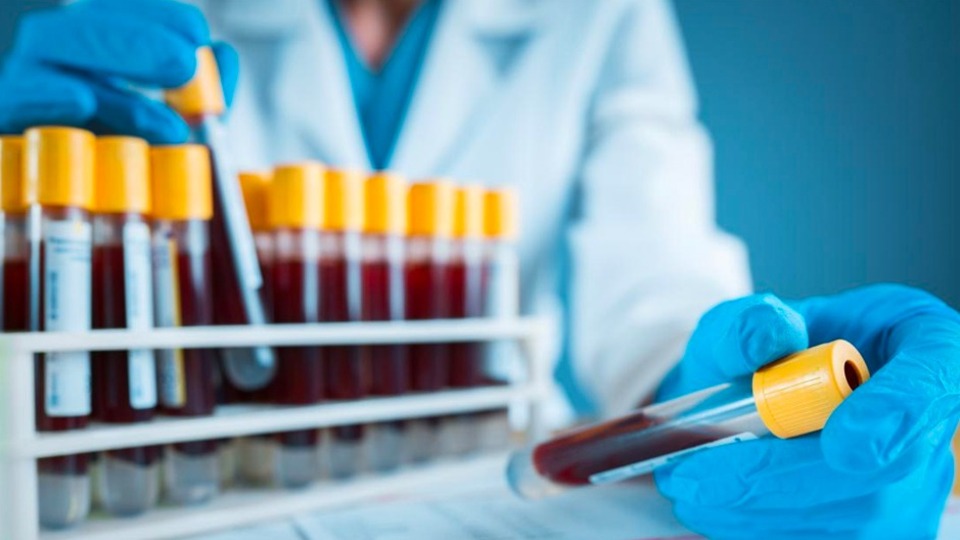 Alzheimer tanısında yeni altın standart! Basit bir kan testiyle doğru ve tutarlı sonuç