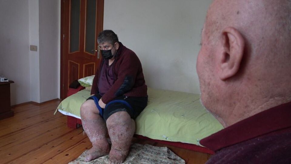 Her şey 9 yıl önce başladı! Sivrisinek ısırığı hayatını kararttı