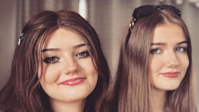 Tek yumurta ikizlerinden biri kanser hastası ama belirtiler ikisinde de aynı!