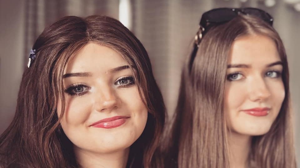 Tek yumurta ikizlerinden biri kanser hastası ama belirtiler ikisinde de aynı!