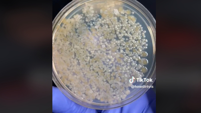 Bakterilerle dolu! O deney ortaya çıkardı, sakın kullanmayın!