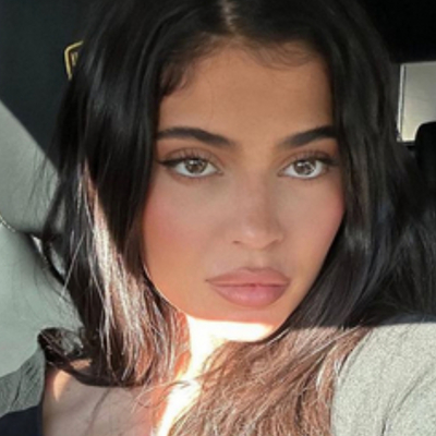 "Yüzümün tamamı estetikli değil"