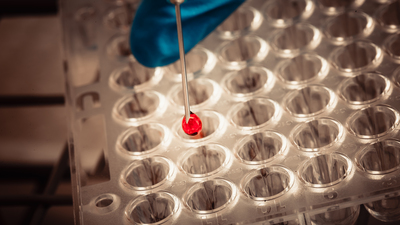 Arjantin'de 40 kişi öldü! Dang humması korkutuyor!